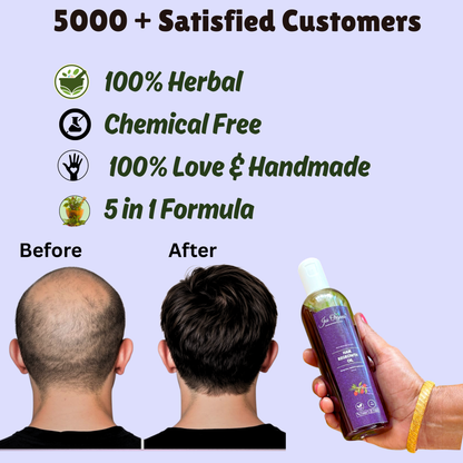 Bald and Regrowth hair kit