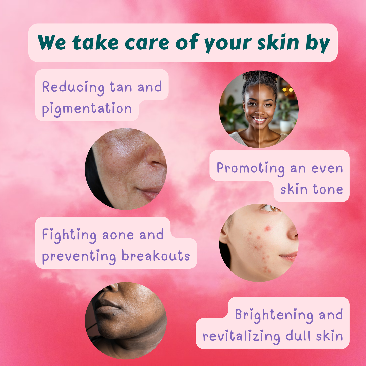 Anti Acne & Anti Pigmentation kit