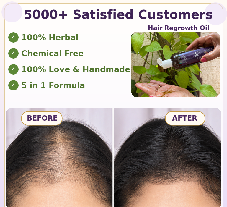 Bald and Regrowth hair kit
